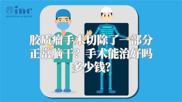 胶质瘤手术切除了一部分正常脑干？手术能治好吗多少钱？