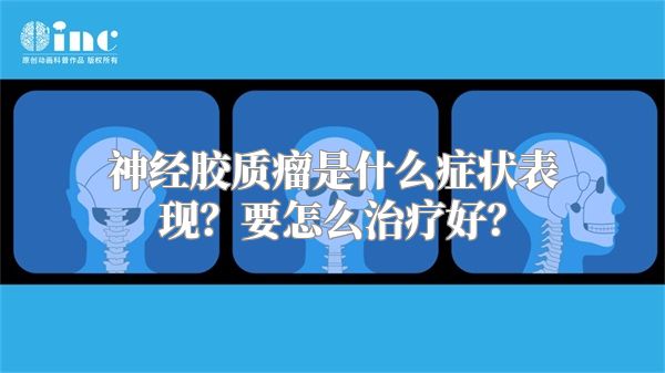 神经胶质瘤是什么症状表现？要怎么治疗好？