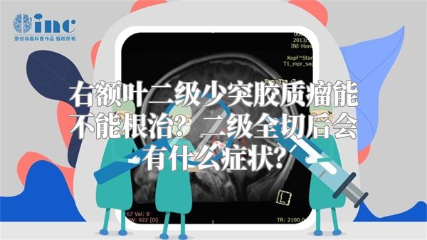 右额叶二级少突胶质瘤能不能根治？二级全切后会有什么症状？