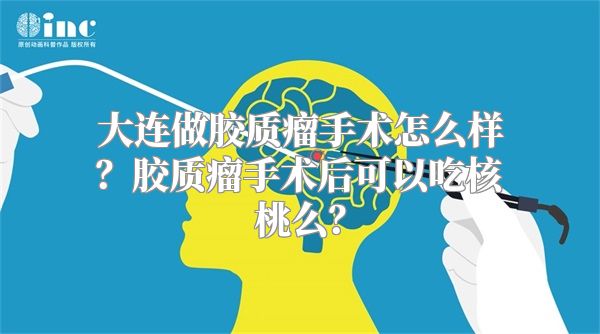 大连做胶质瘤手术怎么样？胶质瘤手术后可以吃核桃么？