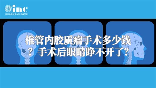 椎管内胶质瘤手术多少钱？手术后眼睛睁不开了？