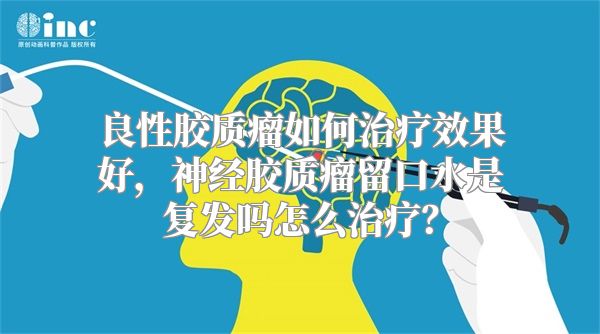 良性胶质瘤如何治疗效果好，神经胶质瘤留口水是复发吗怎么治疗？