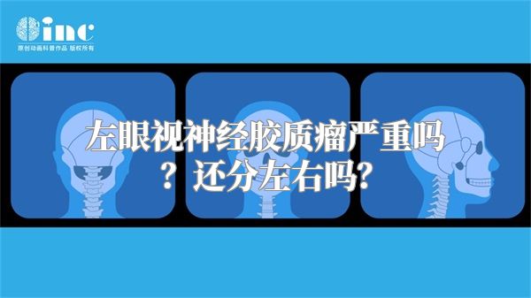 左眼视神经胶质瘤严重吗？还分左右吗？