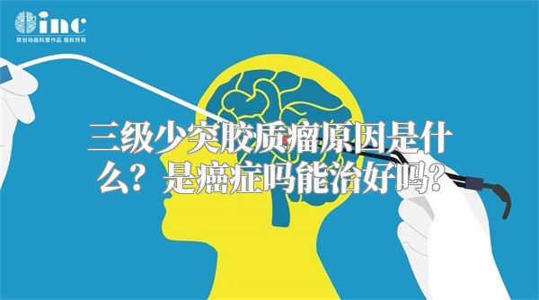 三级少突胶质瘤原因是什么？是癌症吗能治好吗？