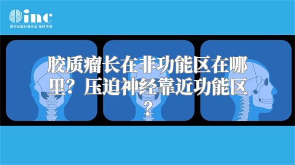 胶质瘤长在非功能区在哪里？压迫神经靠近功能区？