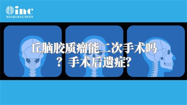 丘脑胶质瘤能二次手术吗？手术后遗症？