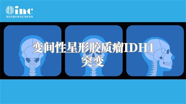 变间性星形胶质瘤IDH1突变