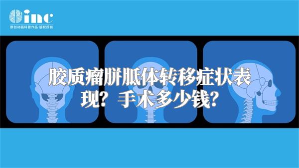 胶质瘤胼胝体转移症状表现？手术多少钱？