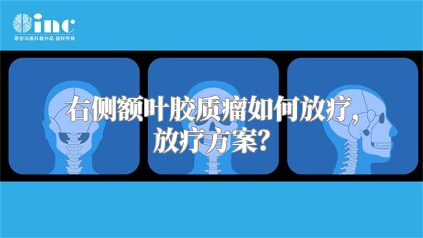 右侧额叶胶质瘤如何放疗，放疗方案？