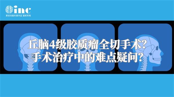 丘脑4级胶质瘤全切手术？手术治疗中的难点疑问？