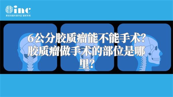 6公分胶质瘤能不能手术？胶质瘤做手术的部位是哪里？