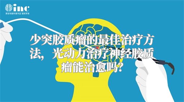 少突胶质瘤的最佳治疗方法，光动力治疗神经胶质瘤能治愈吗？