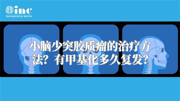 小脑少突胶质瘤的治疗方法？有甲基化多久复发？