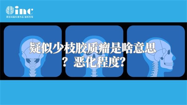 疑似少枝胶质瘤是啥意思？恶化程度？