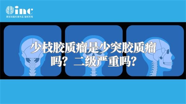 少枝胶质瘤是少突胶质瘤吗？二级严重吗？