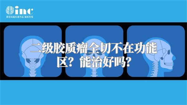 二级胶质瘤全切不在功能区？能治好吗？