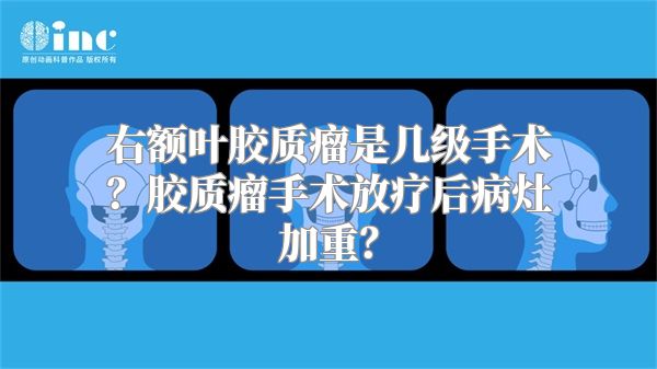 右额叶胶质瘤是几级手术？胶质瘤手术放疗后病灶加重？