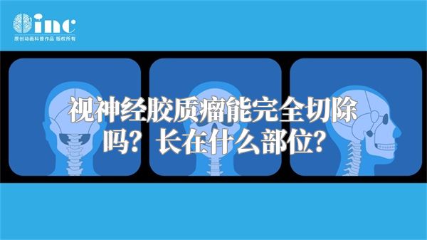 视神经胶质瘤能完全切除吗？长在什么部位？