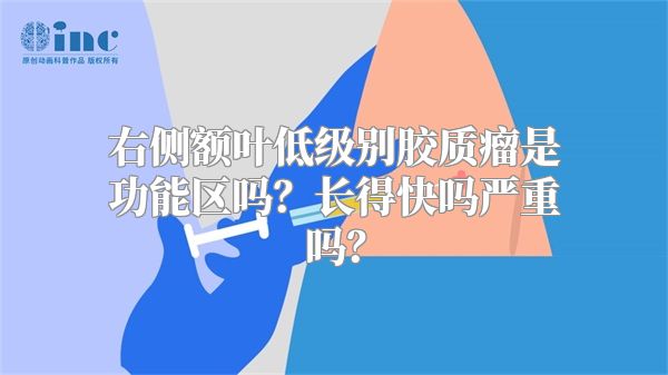 右侧额叶低级别胶质瘤是功能区吗？长得快吗严重吗？