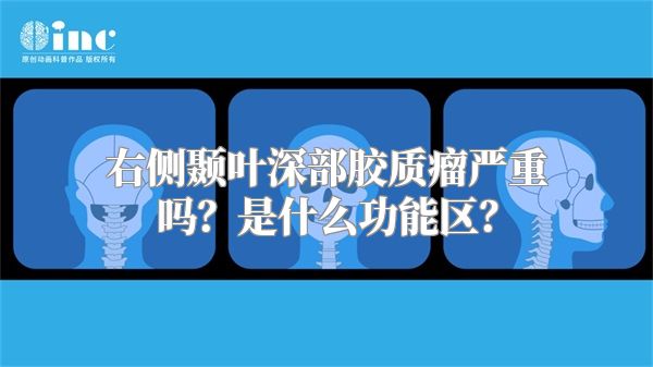 右侧颞叶深部胶质瘤严重吗？是什么功能区？