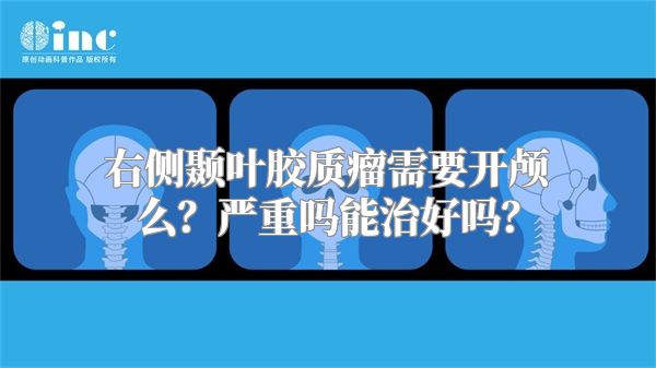 右侧颞叶胶质瘤需要开颅么？严重吗能治好吗？