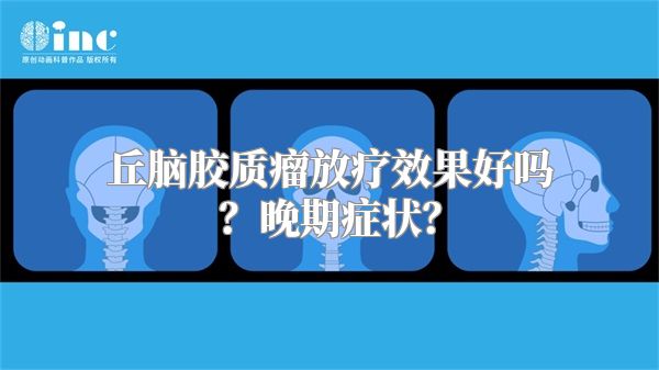 丘脑胶质瘤放疗效果好吗？晚期症状？