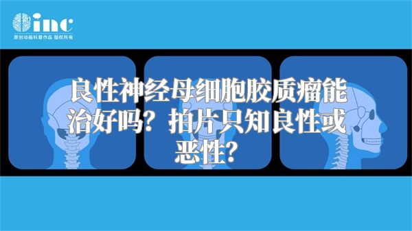 良性神经母细胞胶质瘤能治好吗？拍片只知良性或恶性？