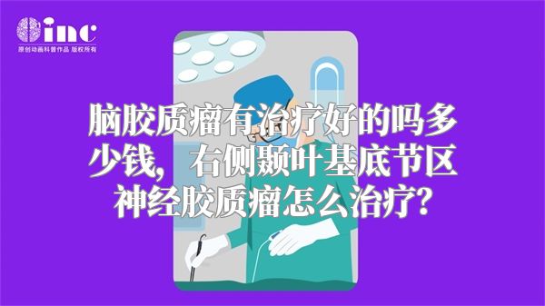 脑胶质瘤有治疗好的吗多少钱，右侧颞叶基底节区神经胶质瘤怎么治疗？