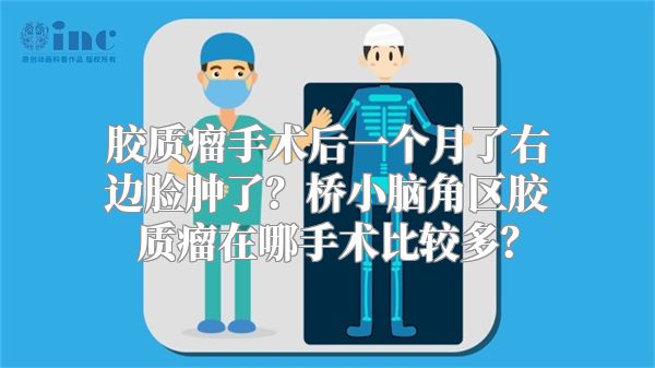 胶质瘤手术后一个月了右边脸肿了？桥小脑角区胶质瘤在哪手术比较多？