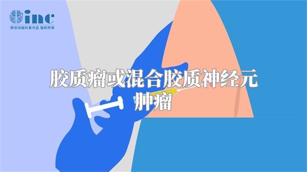 胶质瘤或混合胶质神经元肿瘤