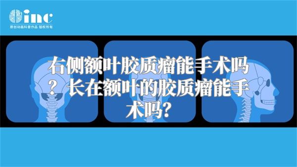 右侧额叶胶质瘤能手术吗？长在额叶的胶质瘤能手术吗？