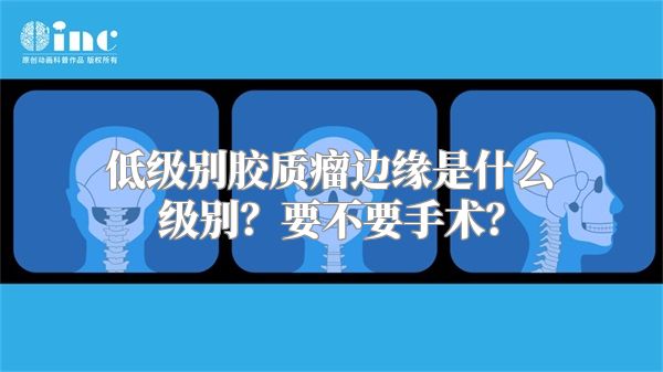 低级别胶质瘤边缘是什么级别？要不要手术？