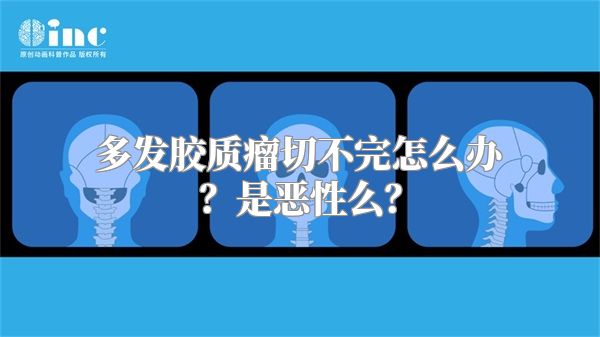 多发胶质瘤切不完怎么办？是恶性么？