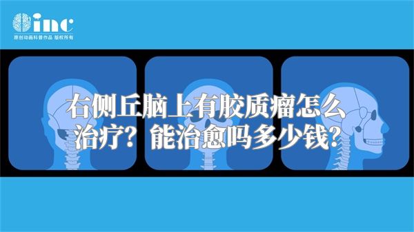 右侧丘脑上有胶质瘤怎么治疗？能治愈吗多少钱？