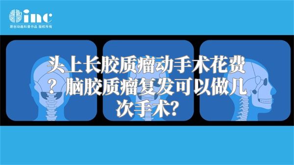 头上长胶质瘤动手术花费？脑胶质瘤复发可以做几次手术？