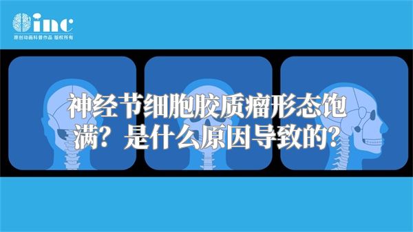 神经节细胞胶质瘤形态饱满？是什么原因导致的？