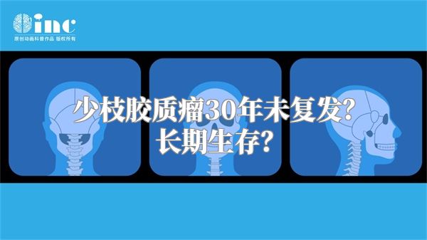 少枝胶质瘤30年未复发？长期生存？