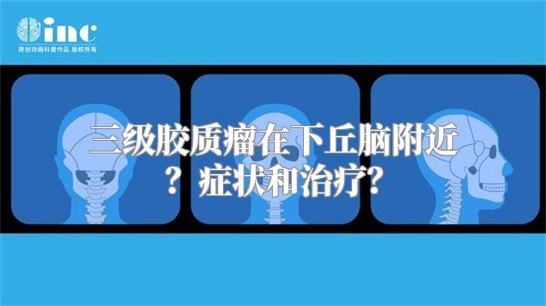 三级胶质瘤在下丘脑附近？症状和治疗？