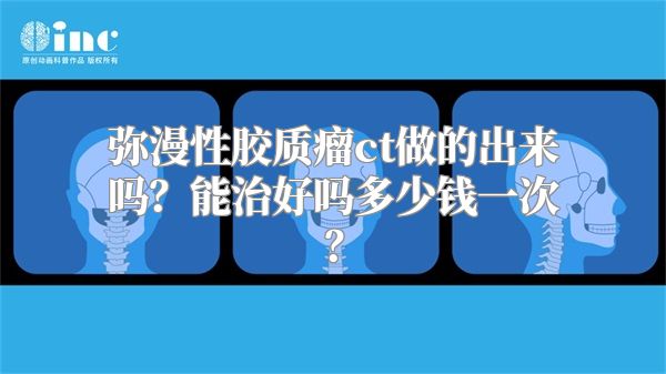 弥漫性胶质瘤ct做的出来吗？能治好吗多少钱一次？