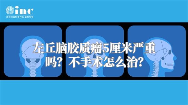 左丘脑胶质瘤5厘米严重吗？不手术怎么治？