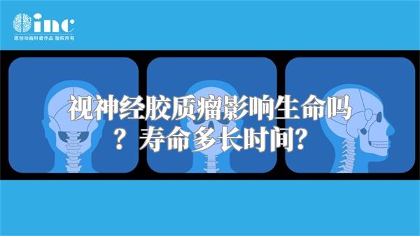 视神经胶质瘤影响生命吗？寿命多长时间？