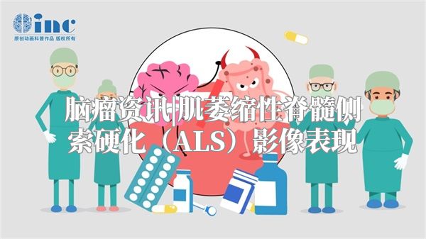 脑瘤资讯|肌萎缩性脊髓侧索硬化（ALS）影像表现