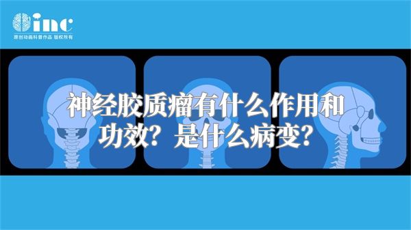 神经胶质瘤有什么作用和功效？是什么病变？