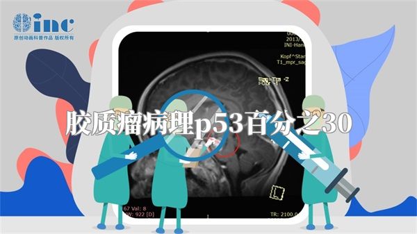 胶质瘤病理p53百分之30