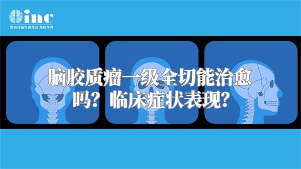 脑胶质瘤一级全切能治愈吗？临床症状表现？