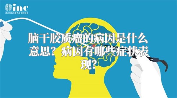 脑干胶质瘤的病因是什么意思？病因有哪些症状表现？