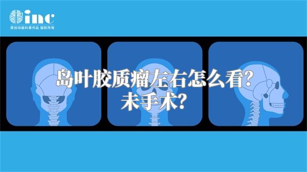 岛叶胶质瘤左右怎么看？未手术？