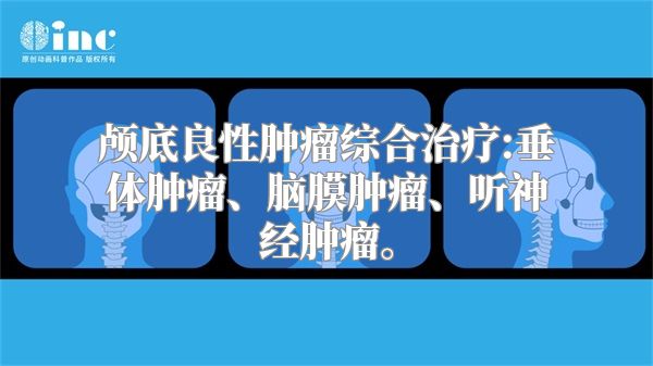 颅底良性肿瘤综合治疗:垂体肿瘤、脑膜肿瘤、听神经肿瘤。