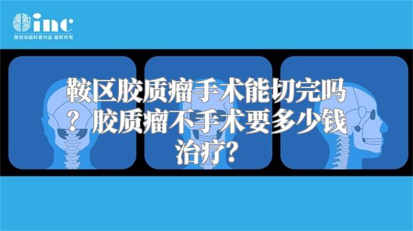 鞍区胶质瘤手术能切完吗？胶质瘤不手术要多少钱治疗？