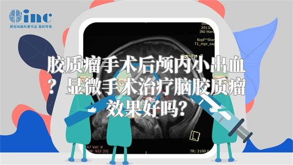 胶质瘤手术后颅内小出血？显微手术治疗脑胶质瘤效果好吗？